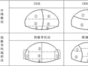 郁金香开花后怎么办 修剪残花尽快补水补肥