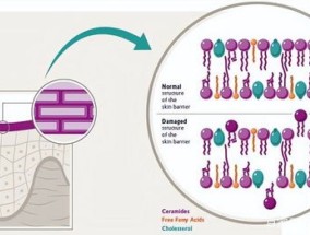 玻色因骗局怎么回事 玻色因使用禁忌有哪些